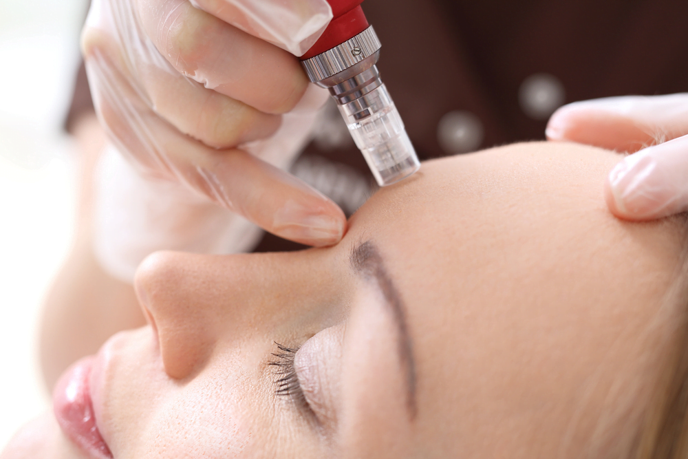 electrolysis melbourne electrolysis melbourne